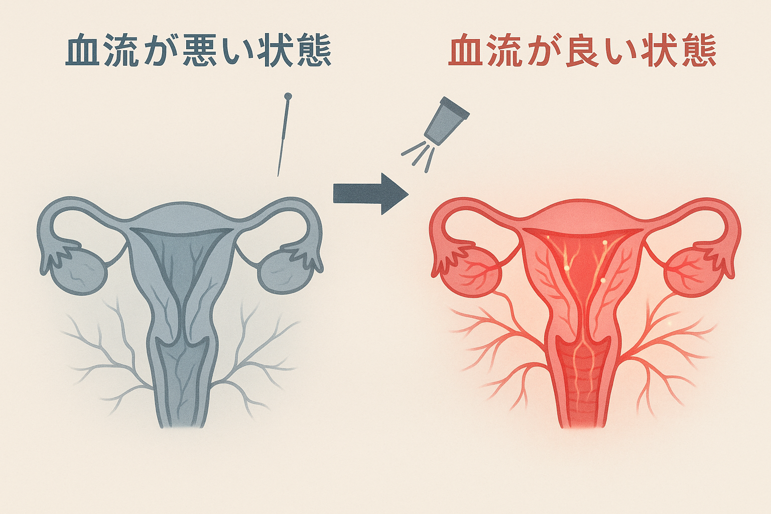 鍼灸とスーパーライザーによる血流改善の図解
