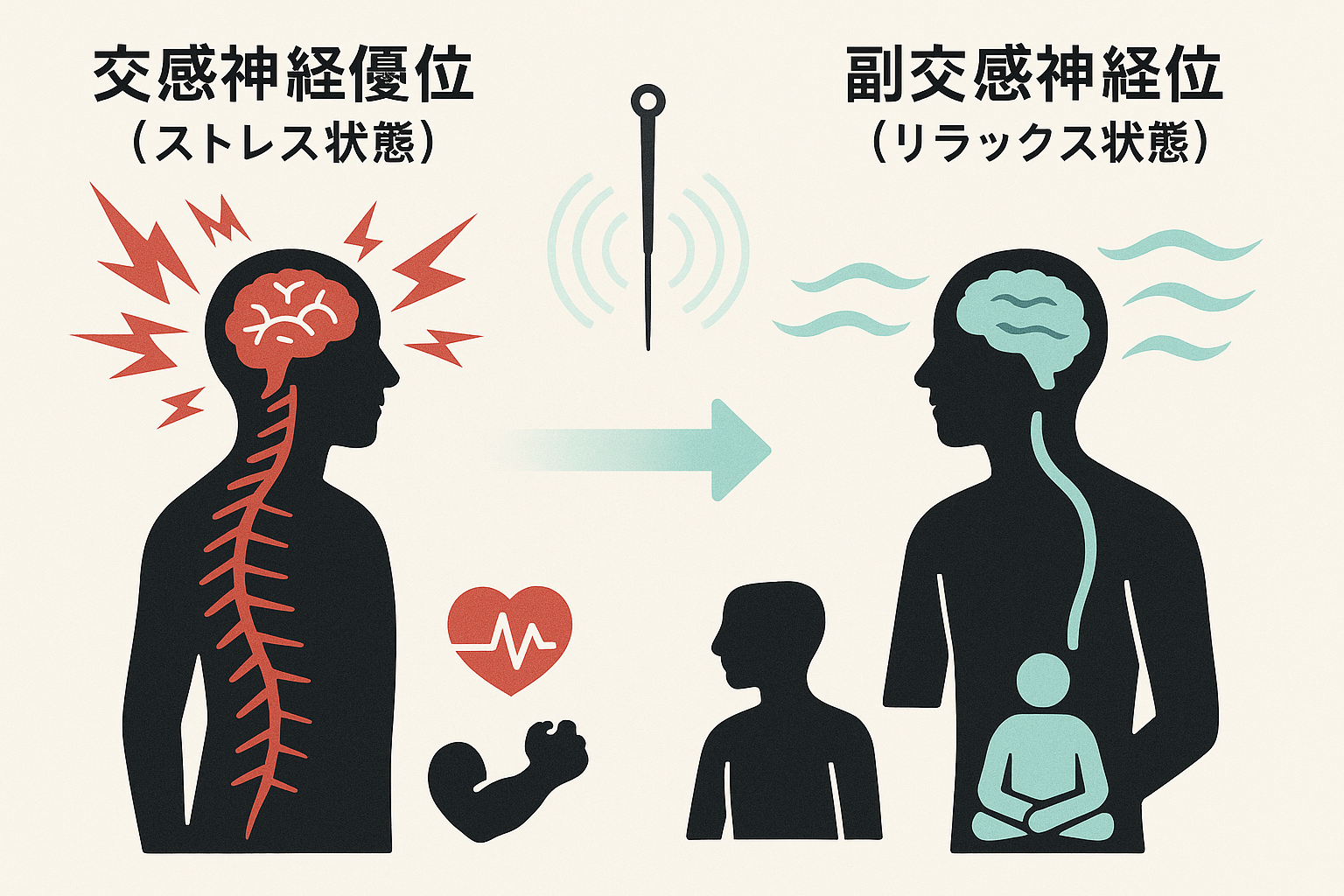 鍼灸による自律神経調整とストレス軽減の図解